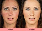 Kojic Acid Brightening Serum & Dark Spot Cream