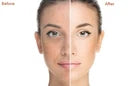 Extreme Whitening Face & Body Cream – Dark Spot & Blemish Care