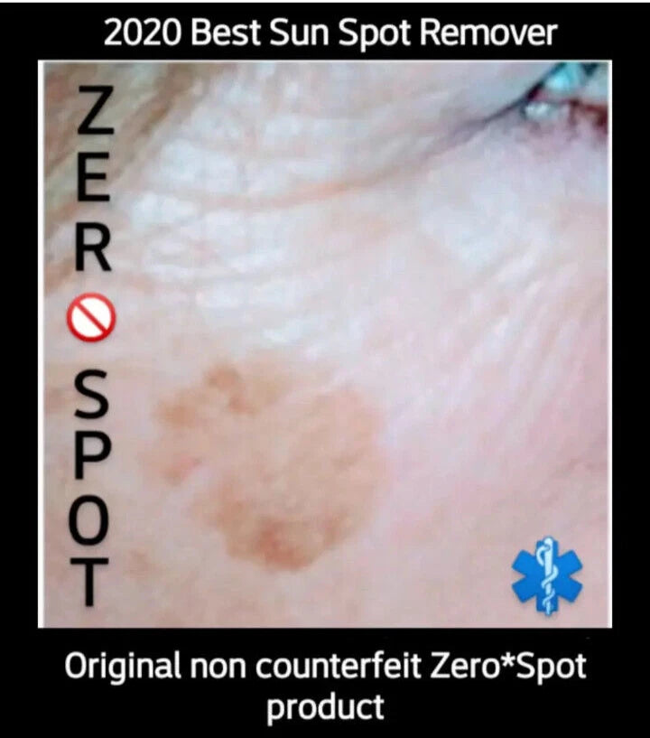 Short Title: Sun Spot & Dark Spot Corrector – Age Spot Treatment