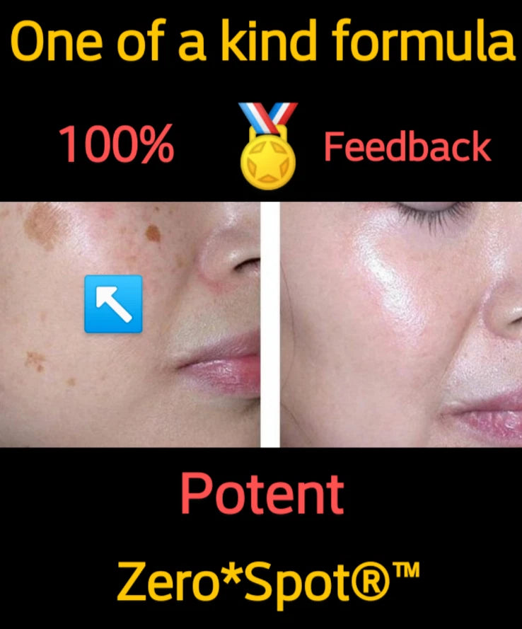 Short Title: Sun Spot & Dark Spot Corrector – Age Spot Treatment