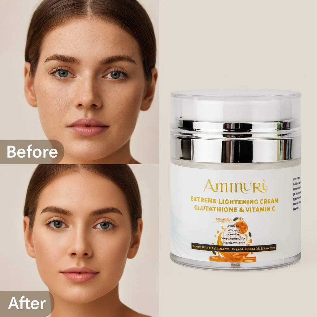 Extreme Whitening Face & Body Cream – Dark Spot & Blemish Care