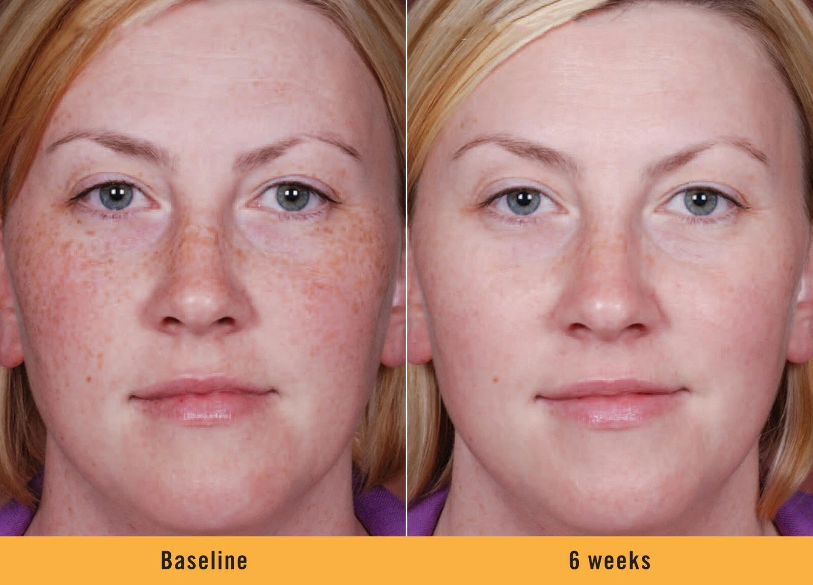 Kojic Acid Brightening Serum & Dark Spot Cream