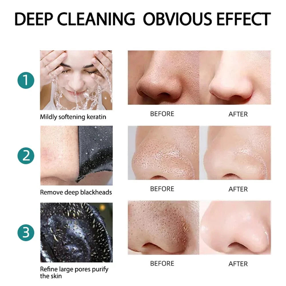 BTF Blackhead Nose Pore Strips – Deep Cleansing Blackhead Removal – 10 Strips