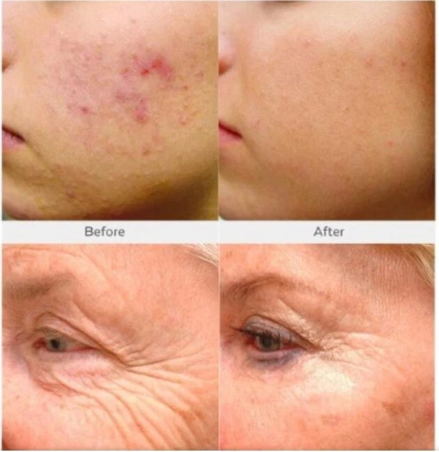 Vitamin C & Collagen Face Serum – Brightening & Anti-Aging 8oz