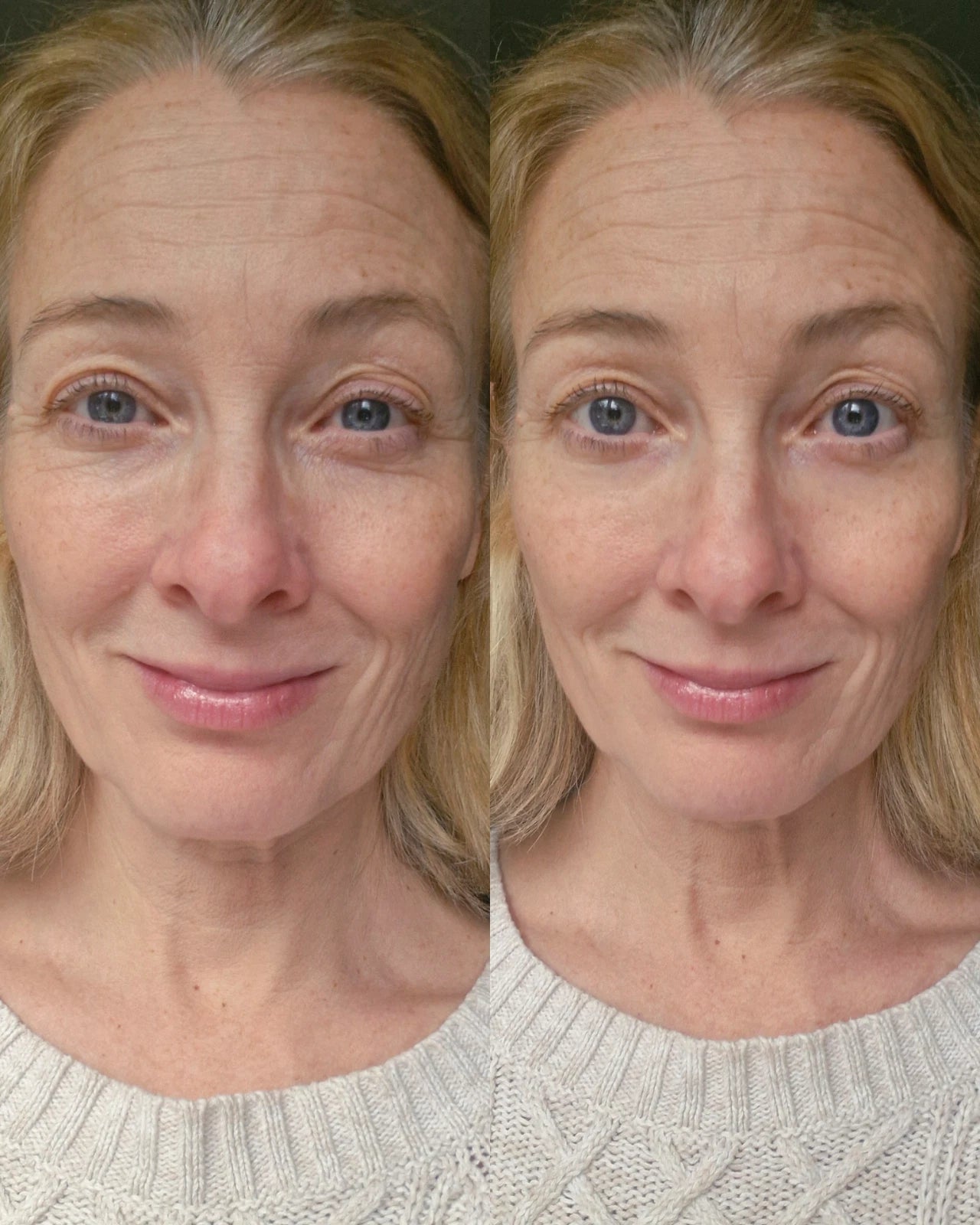 Eyesential Instant Wrinkle Serum Instant Fine Line & Wrinkle Smoothing – 20 mL