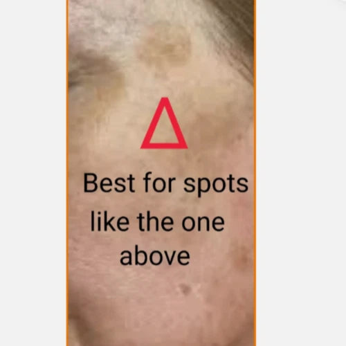 Short Title: Sun Spot & Dark Spot Corrector – Age Spot Treatment