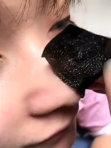 BTF Blackhead Nose Pore Strips – Deep Cleansing Blackhead Removal – 10 Strips